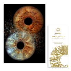 Páros íriszfotó + ajándék effekt